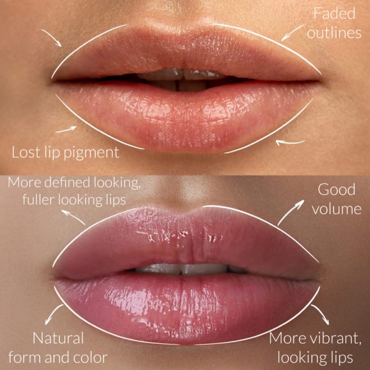 At YOLOve Beauty in Dartmouth, NS, we showcase a stunning transformation with our lip enhancement services. In the top image, you see lips with diminished outlines and lackluster pigment. The bottom image reveals a striking improvement: fuller lips with vibrant color and beautifully defined contours. Descriptive text labels highlight each of these enhancements, demonstrating the remarkable results achieved at YOLOve Beauty.